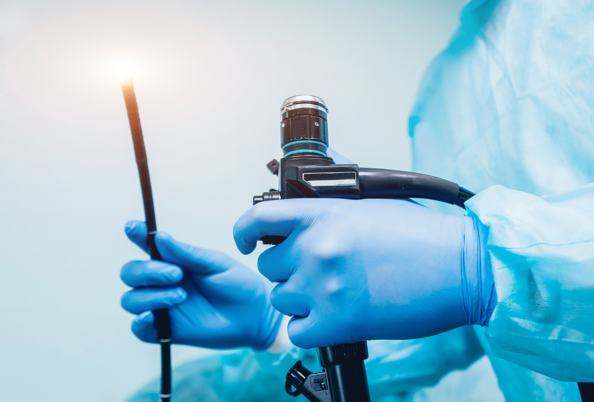 大腸カメラ検査(大腸内視鏡検査)